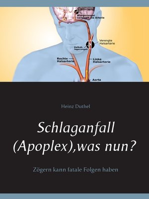 cover image of Schlaganfall (Apoplex), was nun?